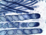 Cheilymenia granulata image