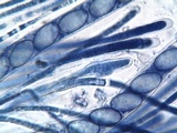 Cheilymenia granulata image