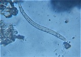 Lophodermium pinastri image