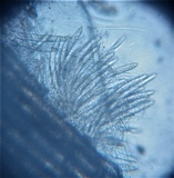Lophodermium pinastri image