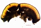 Trapeliopsis glaucopholis image
