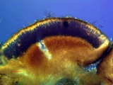 Trapeliopsis glaucopholis image