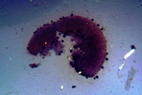 Trapeliopsis glaucopholis image