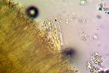Trapeliopsis glaucopholis image