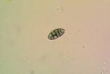 Diploschistes muscorum image