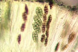 Diploschistes muscorum image