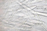Colpoma quercinum image