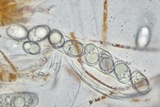Octospora humosa image