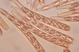 Rutstroemia sydowiana image