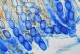 Scutellinia crinita image