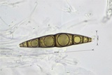 Trematosphaeria hydrela image