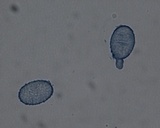 Peziza succosa image