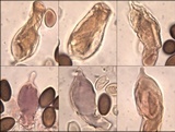 Hypholoma ericaeoides image