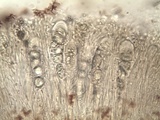 Aspicilia epiglypta image
