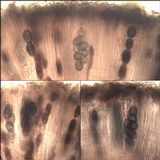Rinodina teichophila image
