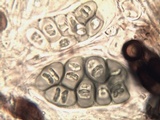 Rinodina teichophila image