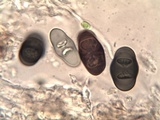 Rinodina teichophila image