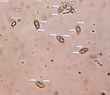 Ramaria apiculata image