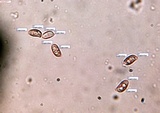 Ramaria rubella image