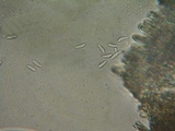 Eriopezia caesia image