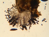 Podospora pleiospora image
