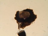 Gloniopsis praelonga image