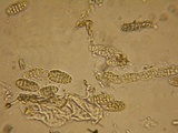 Gloniopsis praelonga image