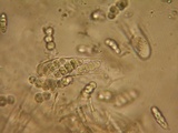 Dyrithium lividum image