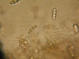 Dyrithium lividum image