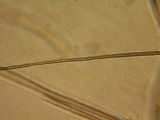 Podospora tarvisina image