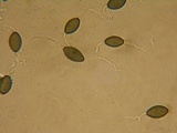 Podospora tarvisina image