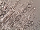 Scutellinia barlae image