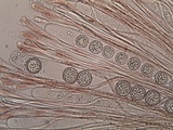 Scutellinia barlae image