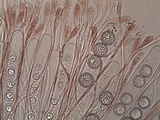 Scutellinia barlae image