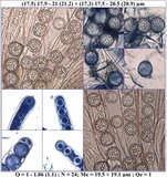 Scutellinia barlae image