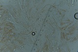 Scutellinia crinita image