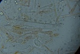 Scutellinia crinita image