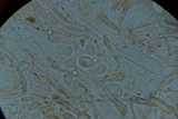 Scutellinia crinita image