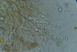 Scutellinia crinita image