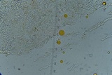 Scutellinia crinita image