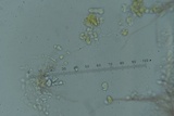 Hypocrea sulphurea image
