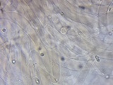 Pluteus petasatus image
