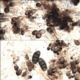Diplotomma hedinii image