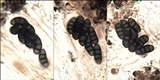 Diplotomma hedinii image