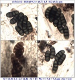 Diplotomma hedinii image