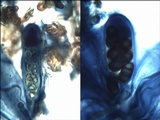 Diplotomma hedinii image
