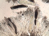 Opegrapha mougeotii image