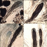 Opegrapha mougeotii image