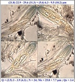 Opegrapha mougeotii image
