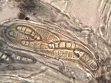Opegrapha mougeotii image
